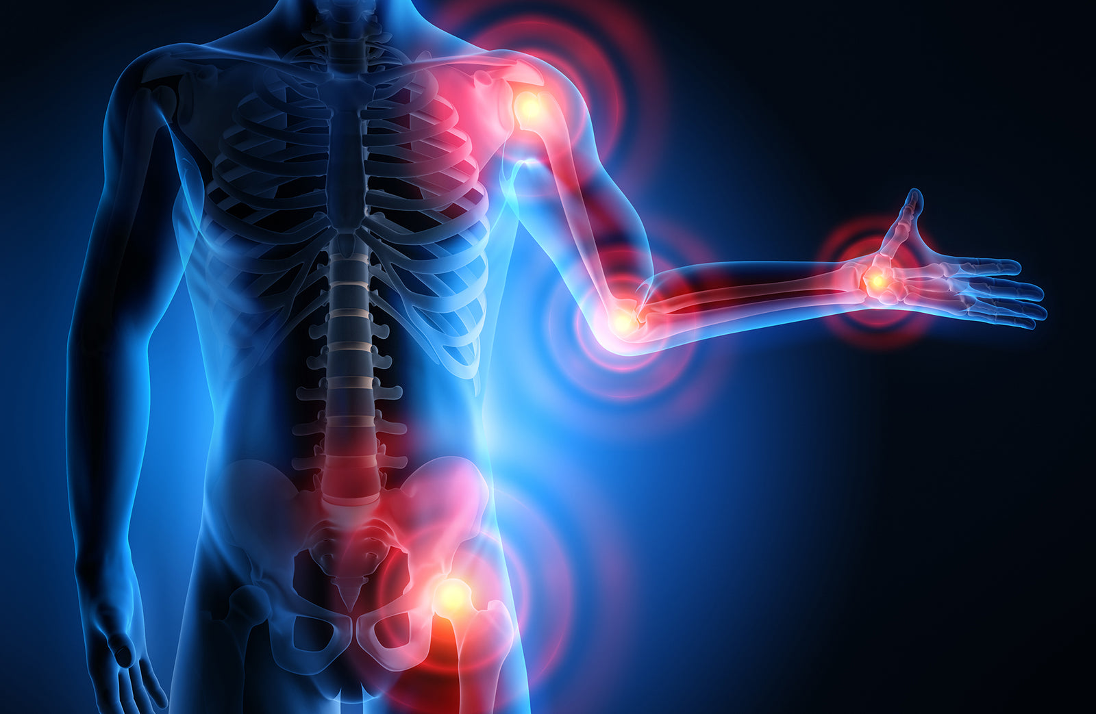 Research Show's CBD is the Best Anti-Inflammatory?